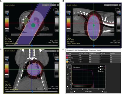 Lisinopril Mitigates Radiation-Induced Mitochondrial Defects in Rat Heart and Blood Cells